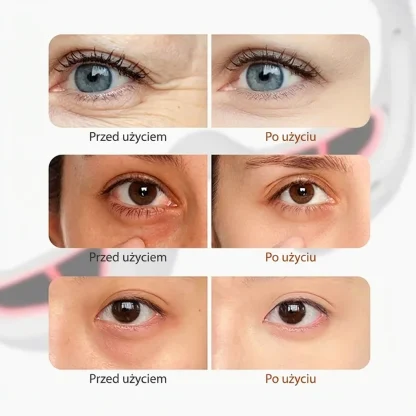 Okulary EyeGlow™ do terapii światłem i pielęgnacji oczu